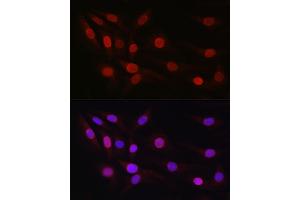 Immunofluorescence analysis of NIH/3T3 cells using SP1 Rabbit pAb (ABIN7270506) at dilution of 1:50 (40x lens). (SP1 anticorps  (AA 420-620))