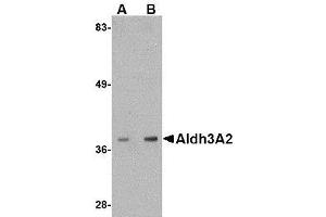 Western blot analysis of Aldh3A2 in mouse liver lysate with AP30044PU-N Aldh3A2 antibody at (A) 1 and (B) 2 μg/ml. (ALDH3A2 anticorps  (C-Term))