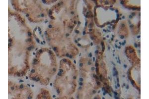 Detection of CK9 in Human Kidney Tissue using Polyclonal Antibody to Cytokeratin 9 (CK9)