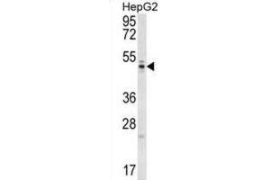 Western Blotting (WB) image for anti-WD Repeat Domain 12 (WDR12) antibody (ABIN5016731) (WDR12 anticorps)