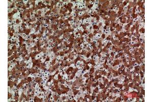 Immunohistochemistry (IHC) analysis of paraffin-embedded Human Liver, antibody was diluted at 1:100.