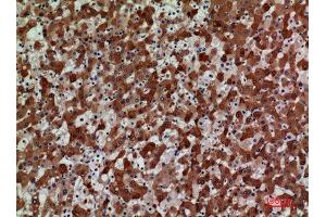 Immunohistochemistry (IHC) analysis of paraffin-embedded Human Liver, antibody was diluted at 1:100. (CCR3 anticorps  (N-Term))