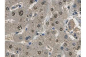 Detection of GAPDH in Human Liver Tissue using Monoclonal Antibody to Glyceraldehyde-3-Phosphate Dehydrogenase (GAPDH)