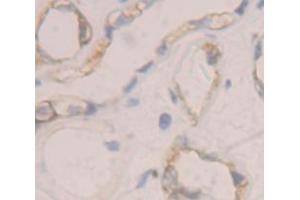 IHC-P analysis of Human Tissue, with DAB staining. (IL12RB1 anticorps  (AA 37-234))
