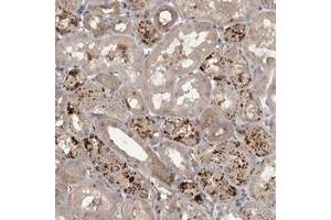 Immunohistochemical staining of human kidney with WDR47 polyclonal antibody  shows distinct cytoplasmic positivity in a subset of renal tubules.