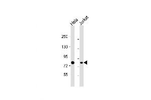Western Blot at 1:1000 dilution Lane 1: Hela whole cell lysate Lane 2: Jurkat whole cell lysate Lysates/proteins at 20 ug per lane. (HADHA anticorps  (C-Term))