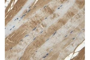 Detection of APOB in Rat Skin Tissue using Polyclonal Antibody to Apolipoprotein B (APOB)