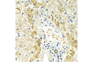 Immunohistochemistry of paraffin-embedded Human liver injury using ERG antibody at dilution of 1:100 (x400 lens). (ERG anticorps  (AA 1-280))
