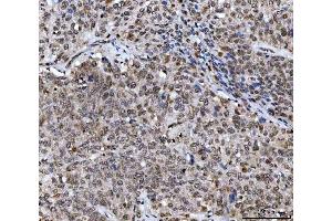 IHC analysis of UBA6 using anti-UBA6 antibody (ABIN7602559). (UBA6 anticorps  (AA 85-1033))