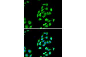 Immunofluorescence analysis of HeLa cells using NFS1 antibody (ABIN6291967). (NFS1 anticorps)