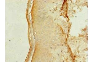 Immunohistochemistry of paraffin-embedded human skin tissue using ABIN7159179 at dilution of 1:100 (MEI1 anticorps  (AA 1-238))