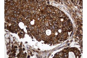 Image no. 1 for anti-TAP Binding Protein-Like (TAPBPL) antibody (ABIN1501302)