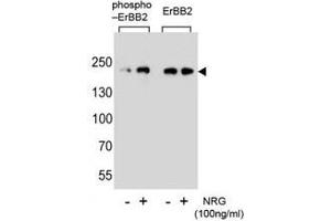 Western blot analysis of extracts from SK-BR-3 cell, untreated or treated with NRG, using phospho-ErbB2 (left) or nonphos Ab (right). (ErbB2/Her2 anticorps  (pTyr1140))