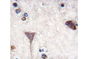 IHC analysis of FFPE human brain tissue stained with B-RAF antibody