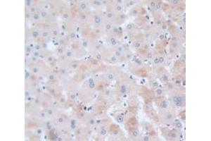 Used in DAB staining on fromalin fixed paraffin- embedded Kidney tissue (VAV1 anticorps  (AA 426-696))