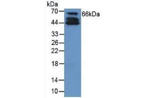 Rabbit Detection antibody from the kit in WB with Positive Control: Sample Human cartilage tissue.