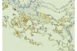 ABIN6275172 at 1/100 staining Human lung tissue by IHC-P. (RRAD anticorps  (Internal Region))