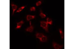 ABIN6274366 staining Hela by IF/ICC. (SURF1 anticorps  (Internal Region))
