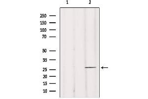 Western blot analysis of extracts from mouse brain, using BRMS1 Antibody.