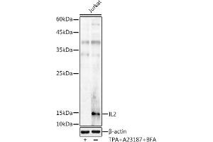 Western blot analysis of extracts of Jurkat cells, using IL2 antibody (ABIN3020908, ABIN3020909, ABIN3020910 and ABIN6213790) at 1:1000 dilution. (IL-2 anticorps  (AA 21-153))