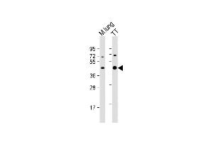 All lanes : Anti-NKX2-1 Antibody (N-term) at 1:2000 dilution Lane 1: mouse lung lysate Lane 2: TT whole cell lysate Lysates/proteins at 20 μg per lane.
