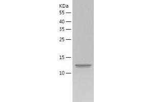 Interleukin 1 eta (FIL1h) (AA 5-157) protein (His-IF2DI Tag)