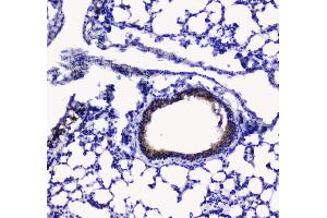 IHC analysis of Betacellulin using anti-Betacellulin antibody .