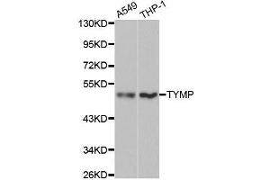 Western blot analysis of extracts of various cell lines, using TYMP antibody. (Thymidine Phosphorylase anticorps  (AA 1-200))