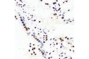 Immunohistochemical analysis of RbAp48 staining in mouse lung formalin fixed paraffin embedded tissue section.