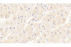 Detection of PRKAg1 in Human Cardiac Muscle Tissue using Polyclonal Antibody to Protein Kinase, AMP Activated Gamma 1 (PRKAg1)