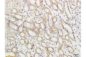 Formalin-fixed and paraffin embedded mouse kidney labeled with Rabbit Anti-APG5L/ATG5 Polyclonal Antibody (ABIN752413) at 1:100 followed by conjugation to the secondary antibody and DAB staining. (ATG5 anticorps  (AA 101-200))