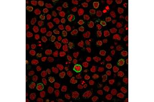 Immunofluorescent staining of PFA-fixed Ramos cells using CD5-Monospecific Mouse Monoclonal Antibody (CD5/2418) followed by goat anti-Mouse IgG conjugated to CF488 (green).