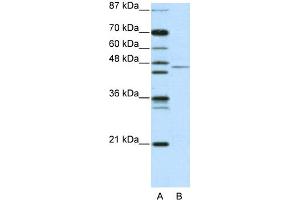 WB Suggested Anti-TRIM14 Antibody   Titration: 2. (TRIM14 anticorps  (N-Term))