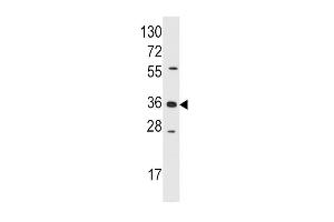 Western blot analysis of anti-AKR1B1 Pab (ABIN389206 and ABIN2839364) in Jurkat cell line lysates (35 μg/lane).