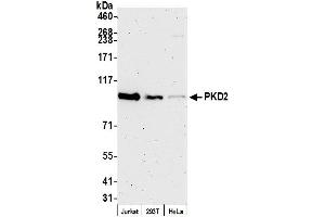 Western Blotting (WB) image for anti-Polycystic Kidney Disease 2 (Autosomal Dominant) (PKD2) (C-Term) antibody (ABIN7453565)