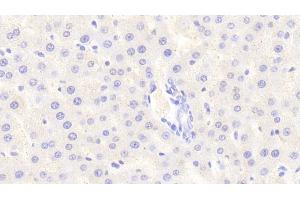 Detection of SIRT4 in Rat Liver Tissue using Polyclonal Antibody to Sirtuin 4 (SIRT4) (SIRT4 anticorps  (AA 60-255))