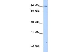 WB Suggested Anti-TMEM24 Antibody Titration:  0.
