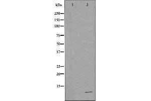 Western blot analysis of extracts of MCF-7 , using TFF1 antibody.