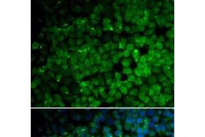 Immunofluorescence analysis of HeLa cells using TRIM13 Polyclonal Antibody (TRIM13 anticorps)