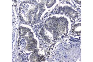 IHC analysis of Hsp105 using anti-Hsp105 antibody (ABIN5693036). (HSPH1 anticorps  (AA 653-858))
