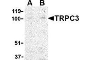Western blot analysis of TRPC3 in mouse heart tissue lysate with this product at (A) 1 and (B) 2 μg/ml. (TRPC3 anticorps  (N-Term))
