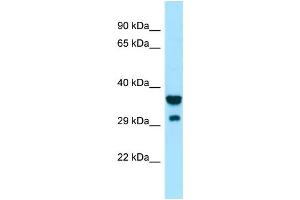 Western Blotting (WB) image for anti-Signal-Regulatory Protein gamma (SIRPG) (Middle Region) antibody (ABIN2790197) (SIRPG anticorps  (Middle Region))