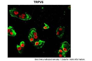 Sample Type: hRetinal pigment epithelial cellsGreen: primaryRed: nuclearPrimary Dilution: 1:200Secondary Antibody: goat anti-rabbit-Alexa 488Secondary Dilution: 1:500Image Submitted by: Brian KennedyIndiana University Northwest .
