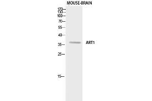 Western Blotting (WB) image for anti-ADP-Ribosyltransferase 1 (ART1) antibody (ABIN5958873) (ART1 anticorps)