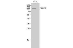 Western Blotting (WB) image for anti-G Protein-Coupled Receptor 113 (GPR113) (N-Term) antibody (ABIN3184836) (GPR113 anticorps  (N-Term))