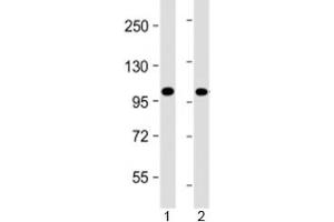 Western blot testing of human 1) Jurkat and 2) K562 cell lysate with PRDM16 antibody at 1:4000.