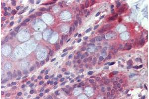 Colon, Human: Formalin-Fixed, Paraffin-Embedded (FFPE) (TPCN2 anticorps  (AA 735-747))