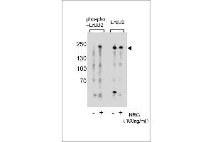 Western blot analysis of extracts from T47D cells, untreated or treated with NRG, 100 ng/mL, using phospho-ErBB2 (left) or ErBB2 Antibody (right). (ErbB2/Her2 anticorps  (pTyr877))