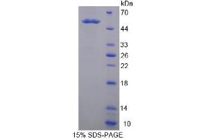 Image no. 1 for Kallikrein 14 (KLK14) (AA 36-267) protein (His tag,GST tag) (ABIN6236982) (Kallikrein 14 Protein (KLK14) (AA 36-267) (His tag,GST tag))