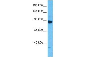 Host:  Rabbit  Target Name:  MCM6  Sample Type:  Jurkat Whole Cell lysates  Antibody Dilution:  1. (MCM6 anticorps  (Middle Region))
